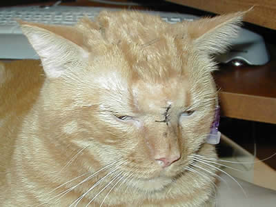After Surgery July 2003